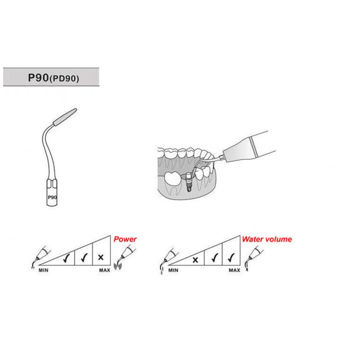 Scaler Tips EMS / Woodpecker Compatible P90 for Implant Cleaning