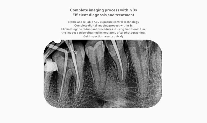 Woodpecker i-Sensor Dental RVG Digital Sensor