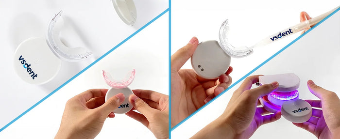 Teeth Whitening Kit