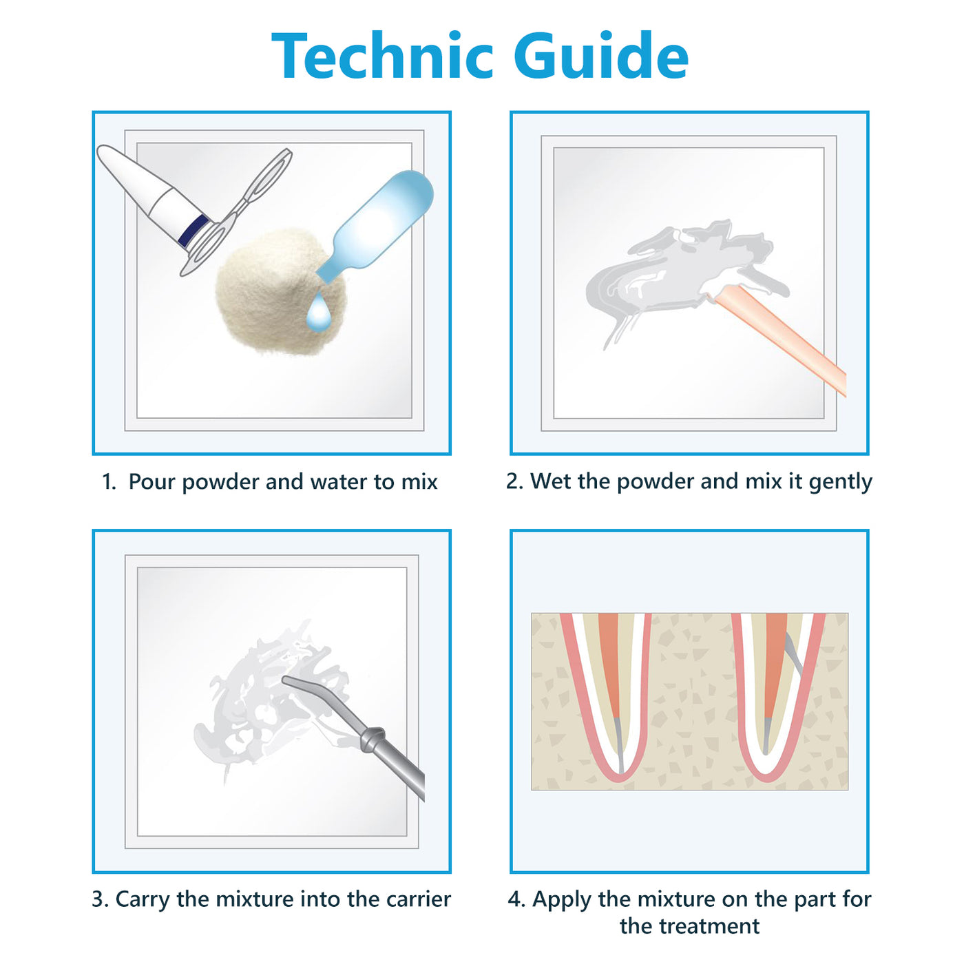 Bioceramic Root Canal Sealer (9480110473526)