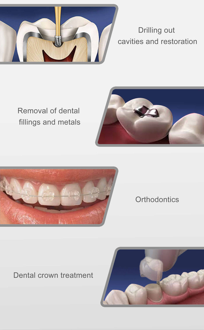 1:5 Tealth Speed Increasing LED Contra Angle Handpiece