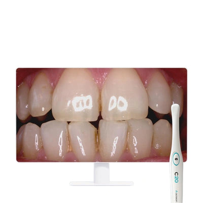 Acteon C20 Full HD Intraoral Camera