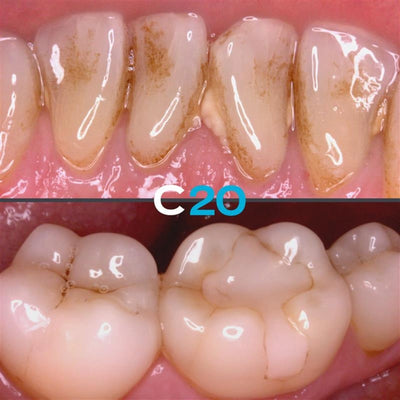 Acteon C20 Full HD Intraoral Camera