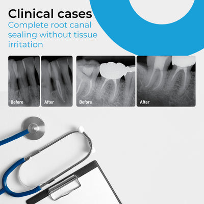 Bioceramic Root Canal Sealer | Default Title | VSDent