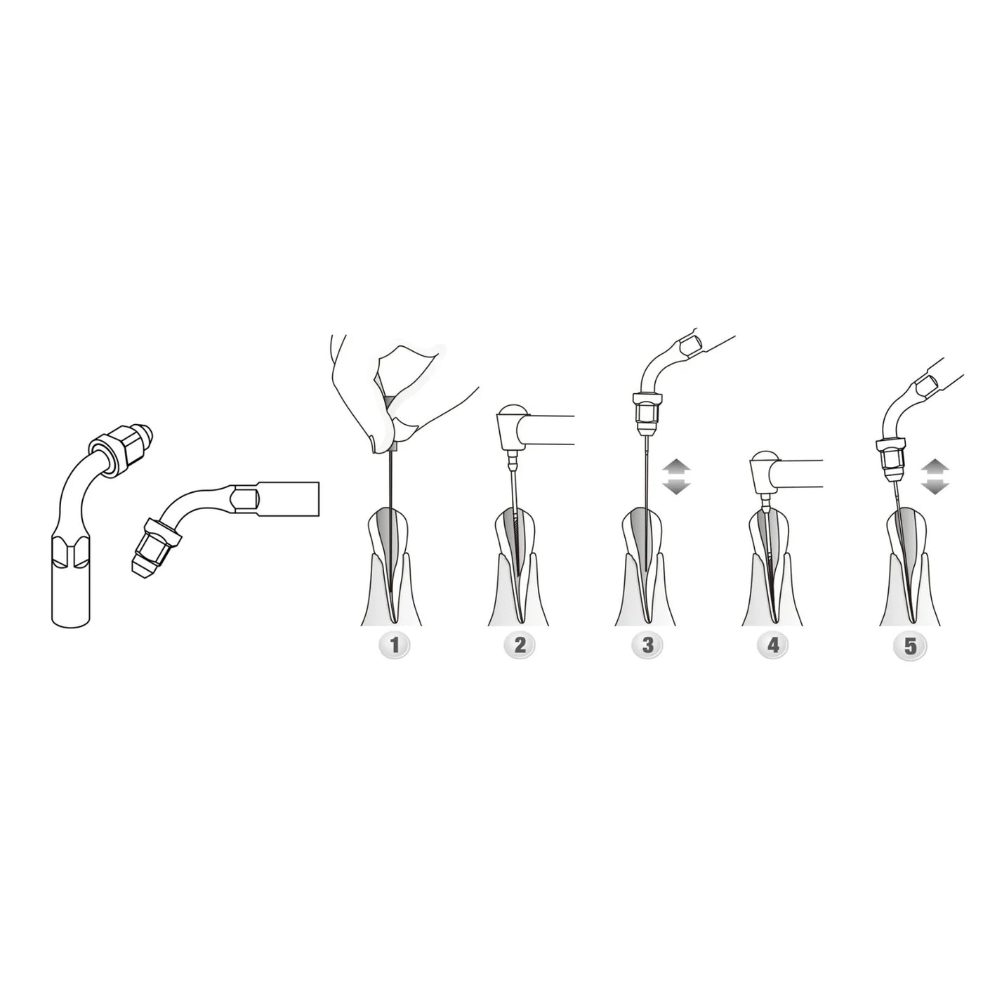 Endo Scaler Tips DTE Compatible (ED)