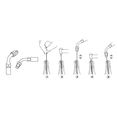 Endo Scaler Tips DTE Compatible (ED)