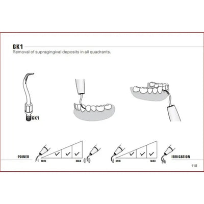 Woodpecker Kavo Compatible Scaler Tips GK1 (14618898497911)