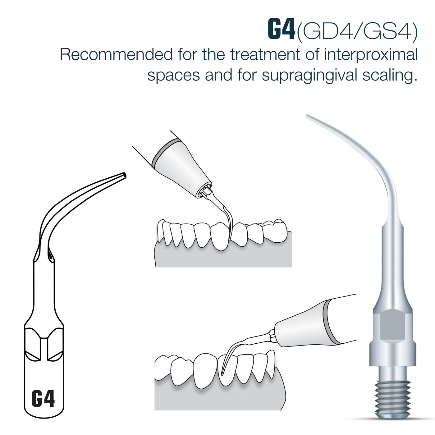 DTE Compatible Scaler Tips GD4 | Default Title | VSDent