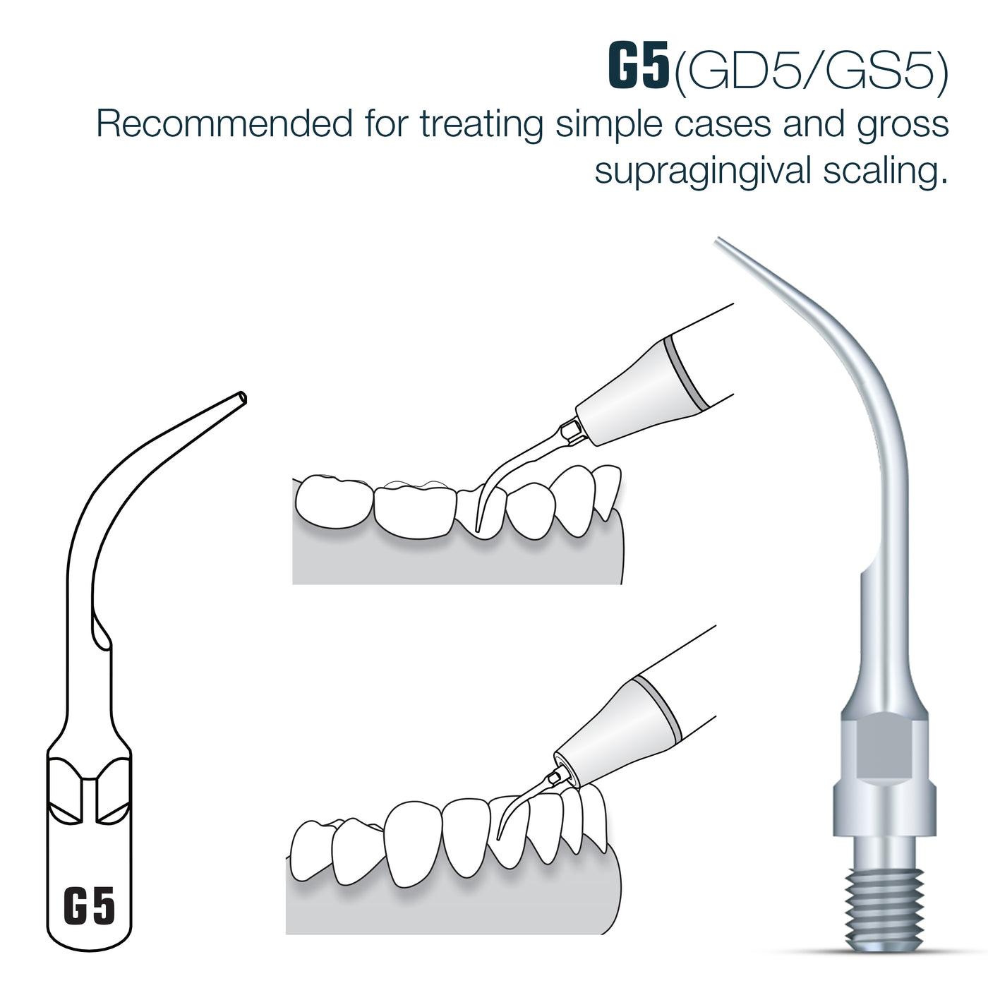 Woodpecker Sirona Compatible Scaler Tips GS5 (14618906231159)