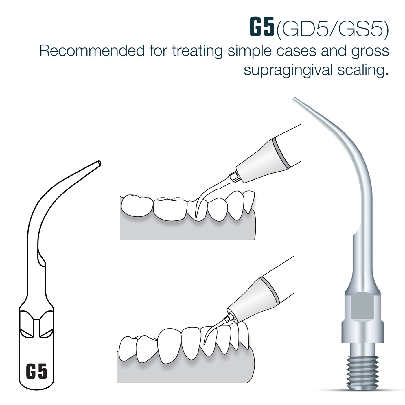 DTE Compatible Scaler Tips GD5 | Default Title | VSDent