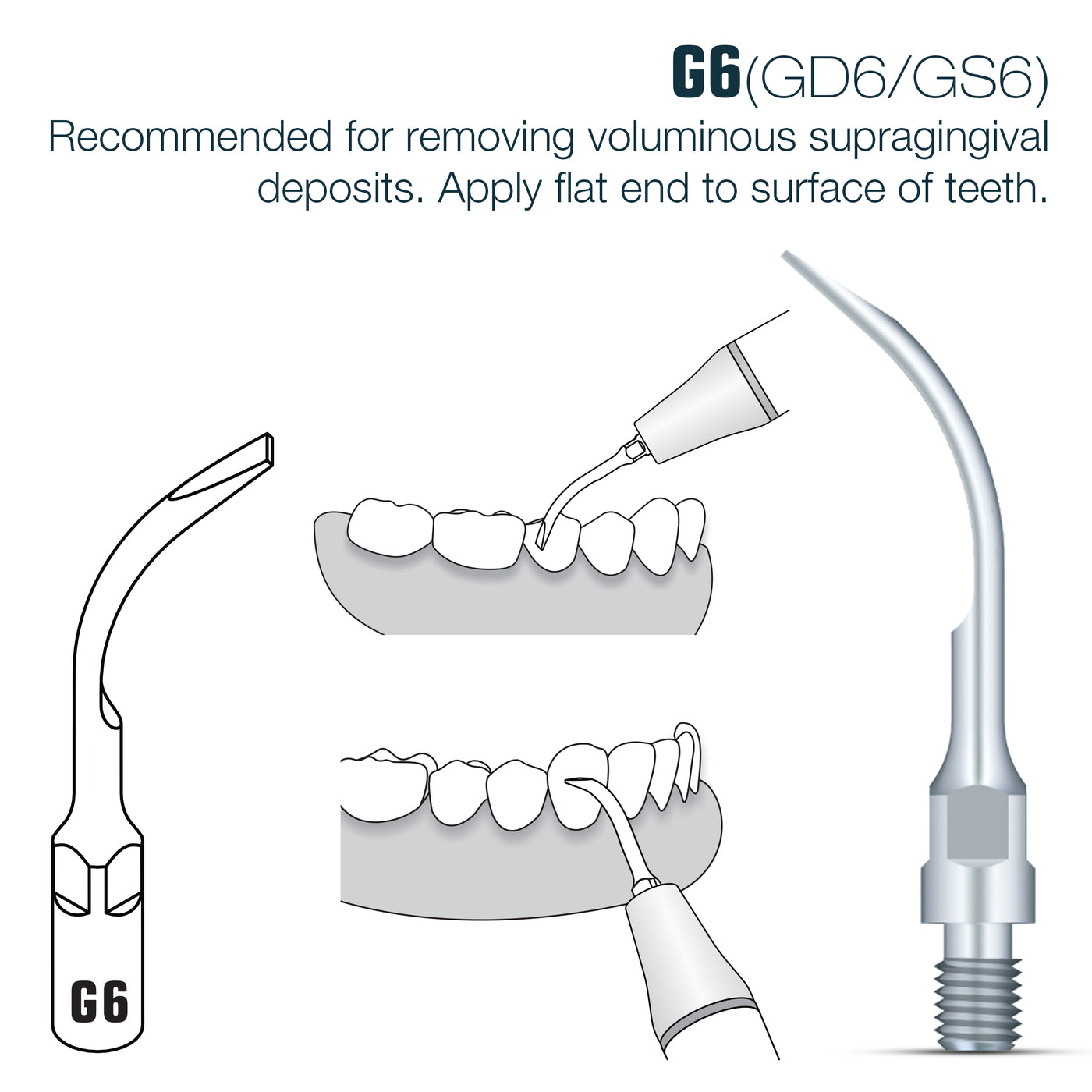 Woodpecker Sirona Compatible Scaler Tips GS6 (14618906853751)