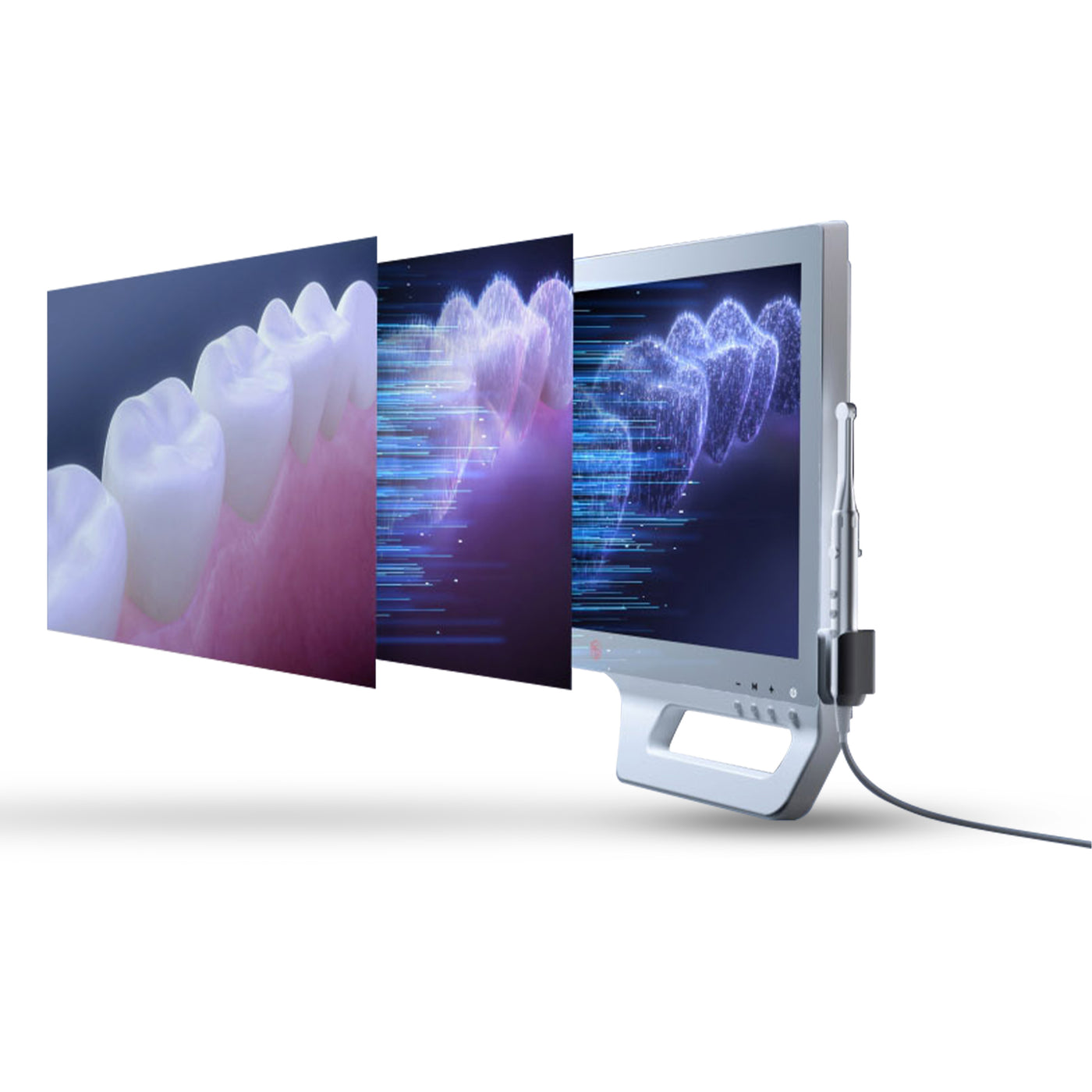 A digital display screen shows a dental image of teeth captured using the Intraoral Camera KP Cam-one by VSDent. The image is segmented into different layers, depicting various analytical stages, including a tooth projection, data visualization, and a graphical representation of dental diagnostics. (8951571841334)
