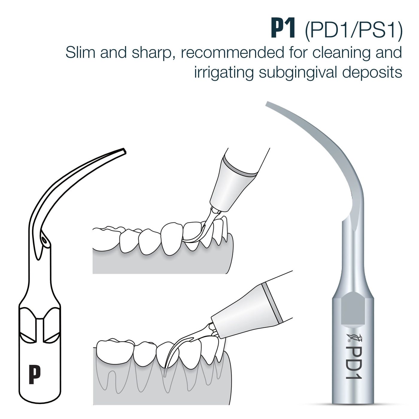 🎁 Perio Scaler Tips DTE Compatible (PD) (100% off) | PD1 | VSDent