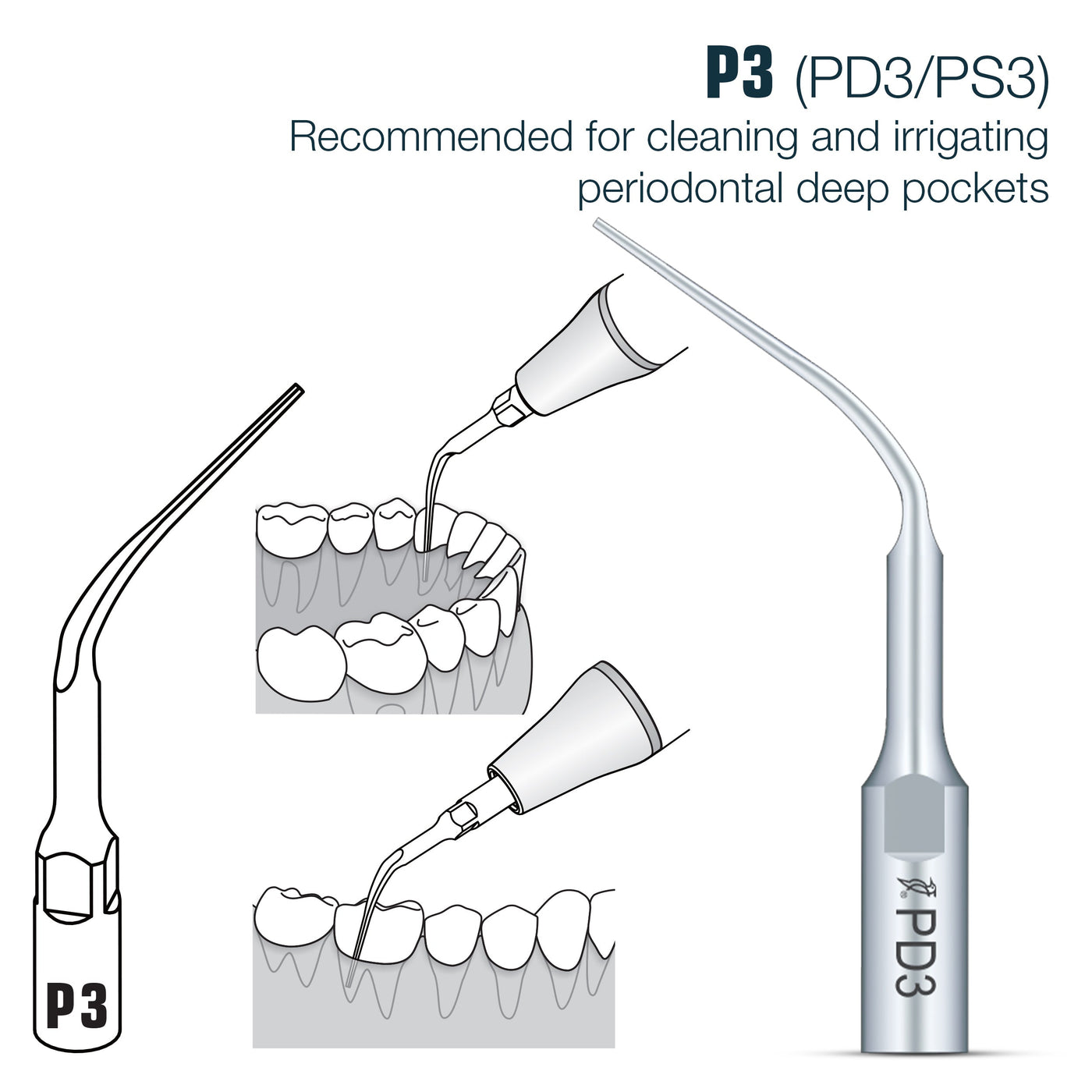 🎁 Perio Scaler Tips DTE Compatible (PD) (100% off) | PD3 | VSDent
