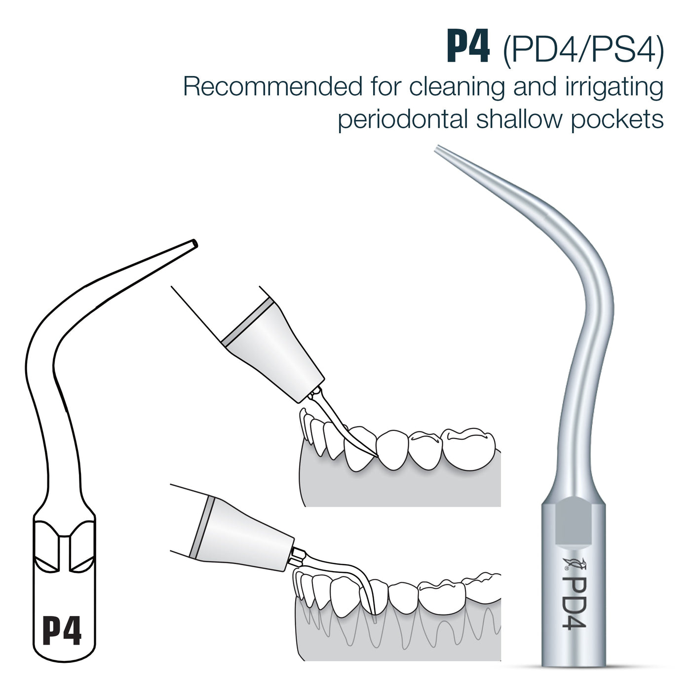 🎁 Perio Scaler Tips DTE Compatible (PD) (100% off) | PD4 | VSDent