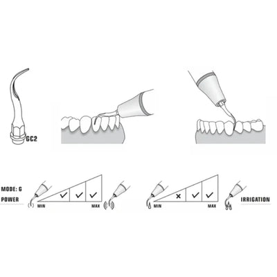 Woodpecker/DTE Kavo Compatible Scaler Tip GC2 (9175815356726)