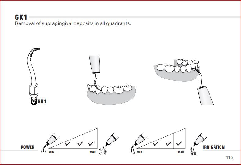 Woodpecker Kavo Compatible Scaler Tips GK1 (14618898497911)