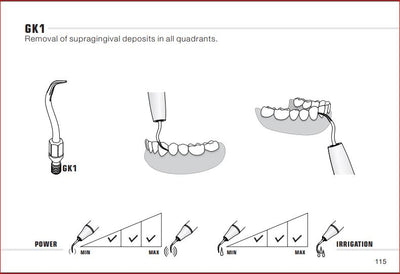 Woodpecker Kavo Compatible Scaler Tips GK1 (14618898497911)