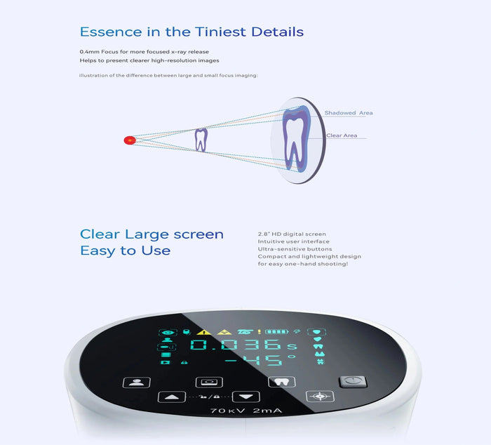 Woodpecker Mini-Ray Portable Hand Held X-Ray Device (Includes Critical Examination Test Certificate)