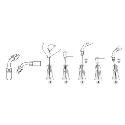 DTE Compatible Endo Scaler Tips ED1