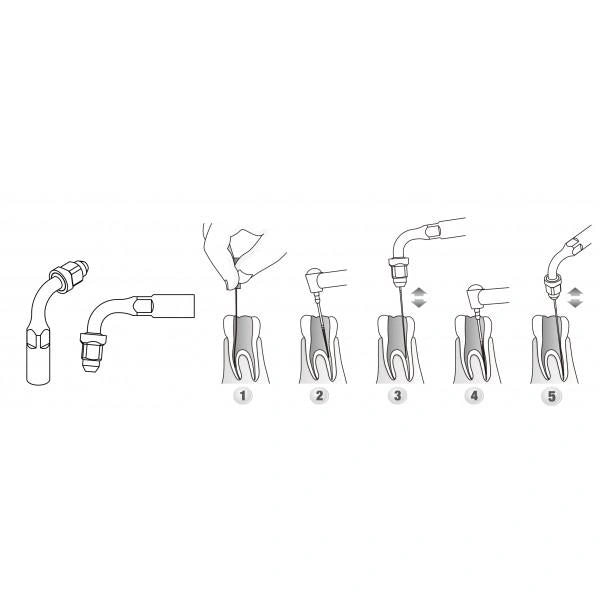 Scaler Tips DTE Compatible ED2