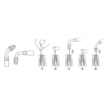 Scaler Tips DTE Compatible ED2