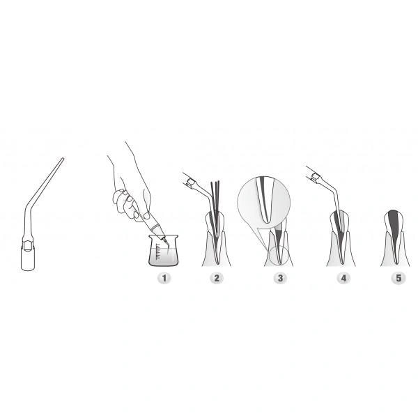 Scaler Tips DTE Compatible ED3