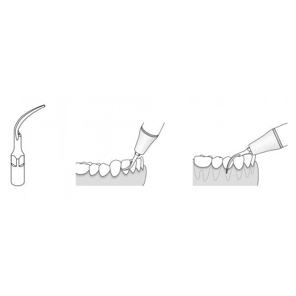 Embouts Détartrants PD1 Pour Pièce à Main à Ultrasons - 5/10/20 Pièces - Compatible Satelec, DTE