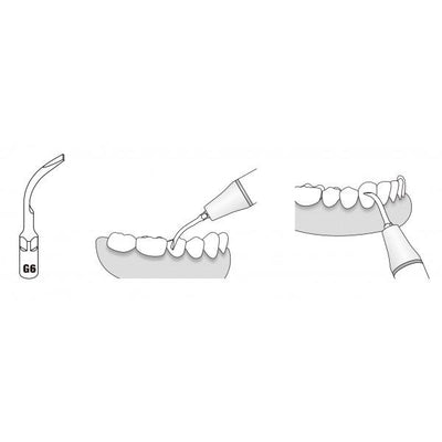 Scaler Tips EMS / Woodpecker Compatible G6 - VSDent (4119997055075)